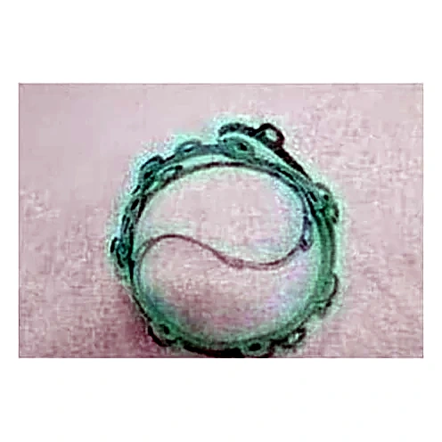 028-11689-000 - Gasket by York
