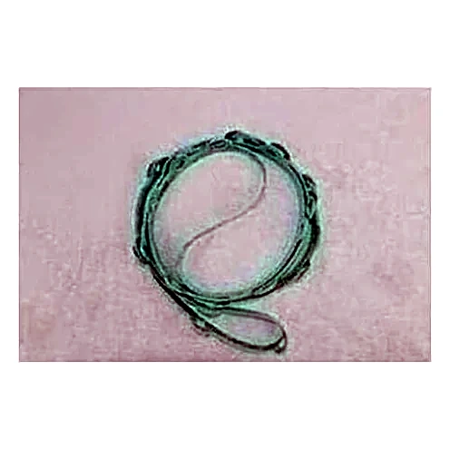 028-11690-000 - Gasket by York